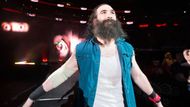 Luke Harper recently underwent surgery on his injured arm